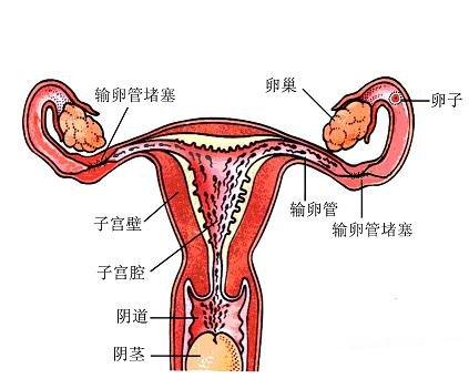 <em>女性</em>需警惕附件炎的危害_<em>沈阳</em>曙光<em>不孕不育</em>医