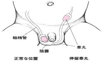 无睾症的诊断_<em>沈阳</em>曙光<em>不孕不育医院</em>