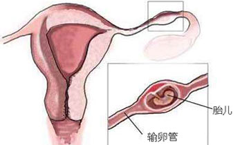<em>女性不排卵怎么办</em>_沈阳曙光医院